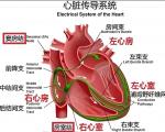 什么是室性早搏？