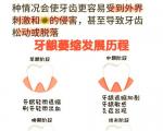 牙龈萎缩的原因有哪些？