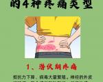带状疱疹的四种疼痛类型