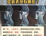 脊髓型颈椎病的症状表现有哪些？