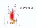 胃食管反流会伤全身