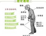 预防帕金森的运动有哪些注意事项？