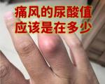 尿酸正常≠不是痛风 痛风急性发作时尿酸也可能正常