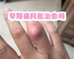 缓解痛风疼痛的物理方法和药物方法可以同时使用吗？