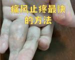 痛风一消不能立刻停药