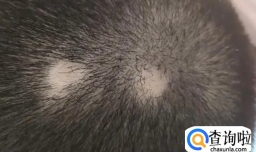 头发掉发严重怎么办（明确脱发的具体原因）