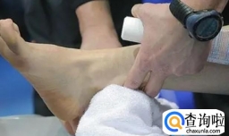 运动崴脚了怎么办