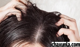 护发素能不能治疗脱发