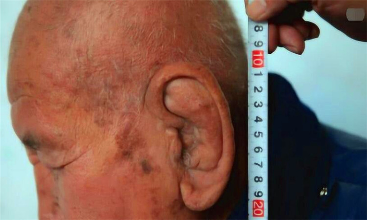 为什么说耳朵大有福气