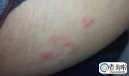 暖宫贴长期使用有副作用吗