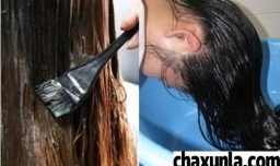 洗发水过敏什么反应