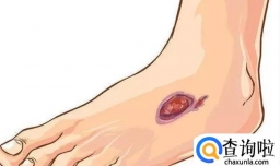 得了前列腺炎  还能过“二人世界”吗  前列腺炎病因