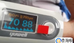 官方明确新冠感染重症标准是什么