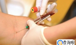 甲流高烧变低烧是什么原因