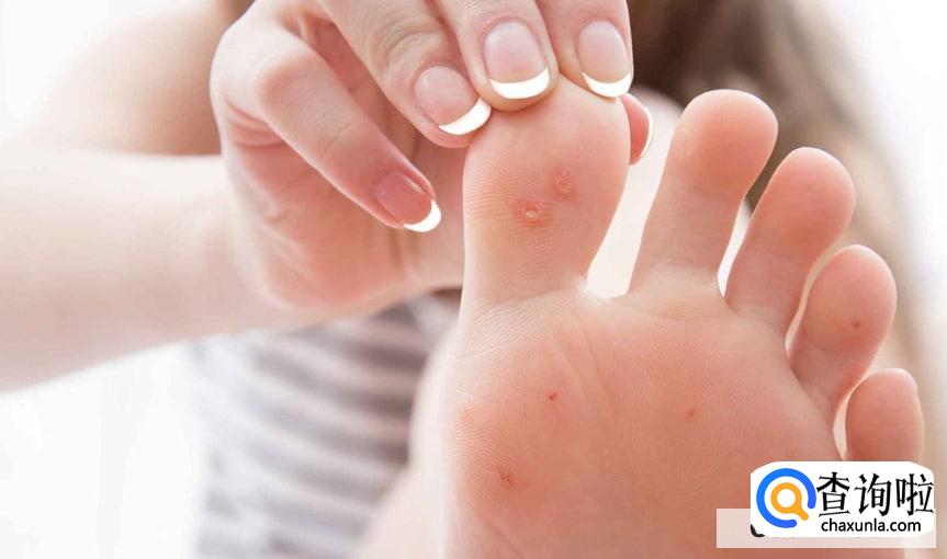 容易脚麻什么原因怎么办