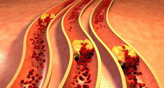 甘油三酯是什么意思