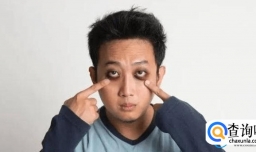 肝变硬，头部会有表现吗？医生提醒：出现这几种情况，建议重视