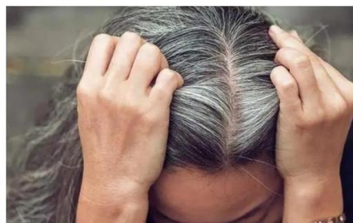 该如何预防少白头