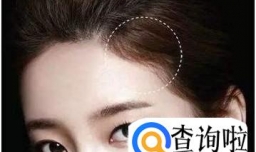 怎样预防发际线后移