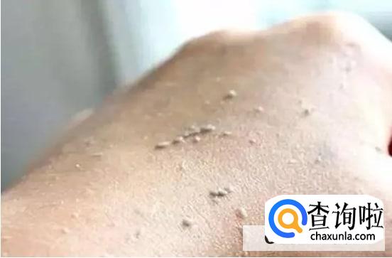 为什么天天洗澡,身体还是会搓出泥呢