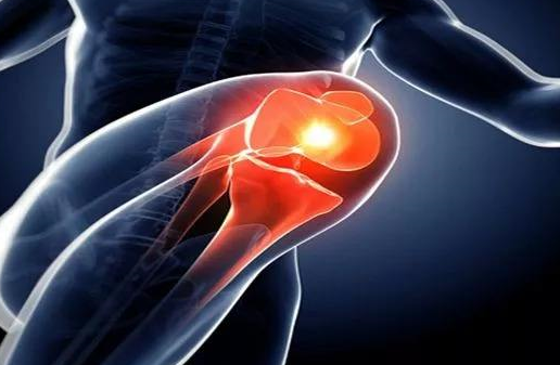 老寒腿只是因为寒吗