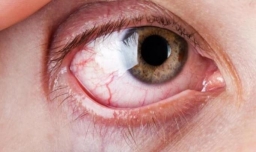 如何挑选适合的美瞳