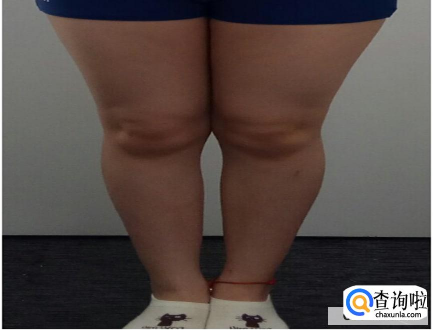 腿粗该怎么挑选裙子BH