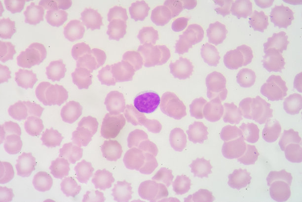 白细胞高说明什么