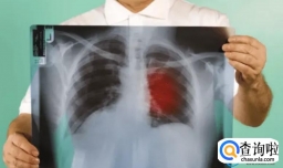 肺部变白是不是就没救了