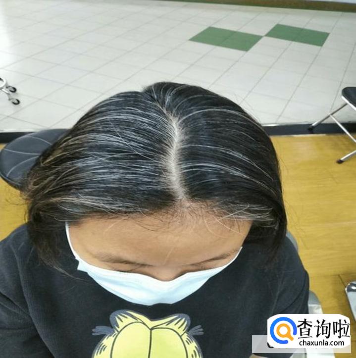 治疗白发的秘方