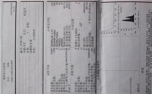 早搏是什么意思