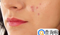 肝不好真的会影响容貌吗？