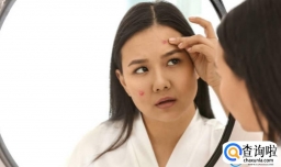 为什么照镜子看不到痘印拍照就有