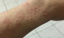 冻榴莲不适合什么人吃