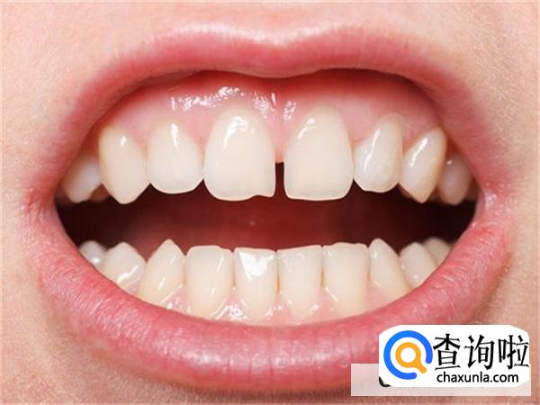 牙齿整形的危害