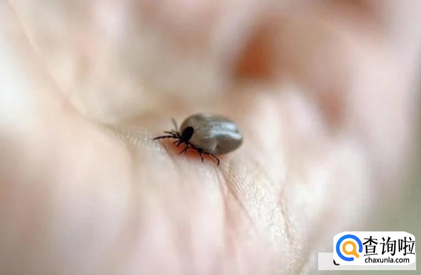 被蜱虫叮咬后怎么办？