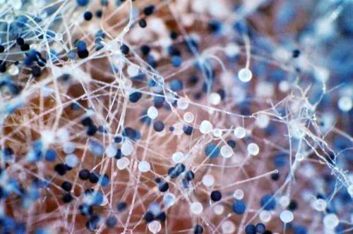 床垫子生小黑虫怎么消除