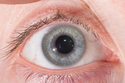 瞳孔放大意味着什么