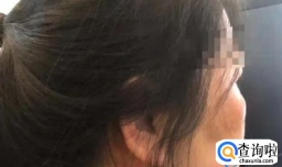 毁容是轻伤还是重伤