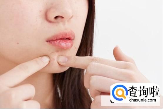 下巴长痘痘是什么火