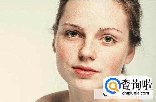 才20岁就有雀斑怎么办