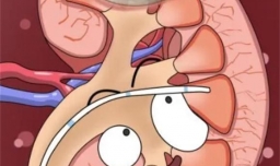 什么是“肾囊肿”？内科医生：7个饮食禁忌，别不当回事