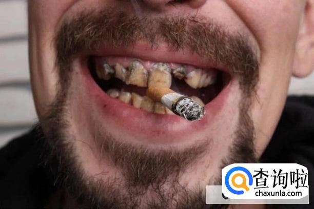 洗牙之后要注意什么