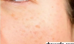 糖跟蜂蜜洗脸可以吗