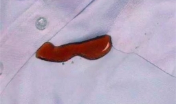 衣服上如果有油印污渍怎么洗净