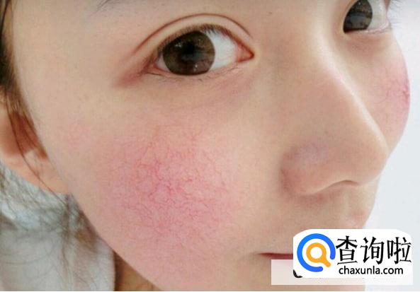 怎么看护肤品过不过敏