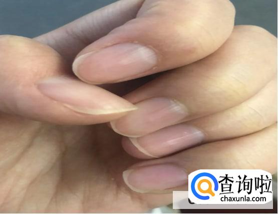 如何判断身体是否健康