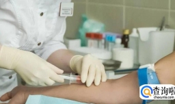 血氧饱和度怎么测