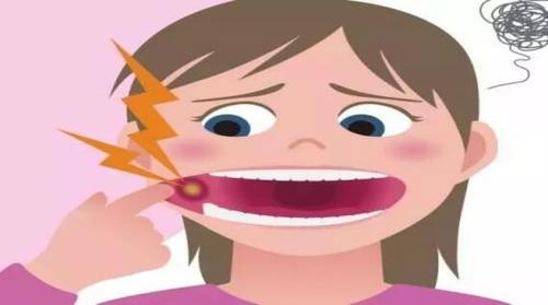 口腔溃疡反复发作怎么根治