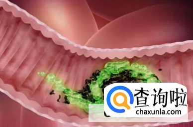 春季该如何清肠排毒